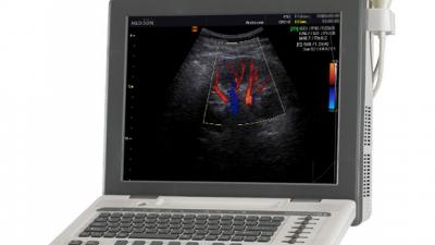 Paediatric ultrasound scan