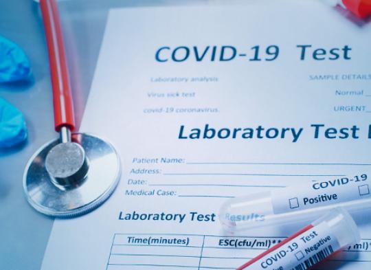 COVID-19 IgG antibody test